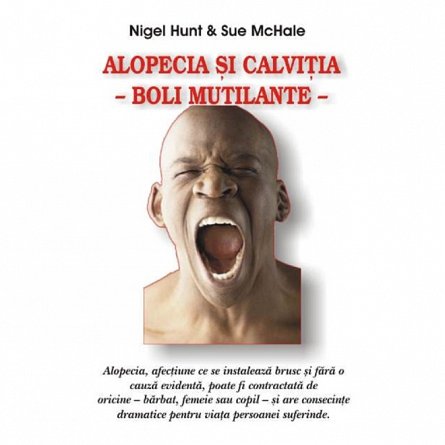 Alopecia si calvitia
